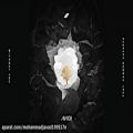 عکس Avicii - Without You “Audio” ft. Sandro Cavazza