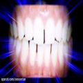 عکس فرکانس یکسان سازی دندانها