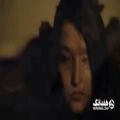 عکس قربانی اسیدپاشی اصفهان در موزیک ویدئوی طرح چشمات