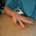عکس تاندون های اجباری - کنترل انگشتها